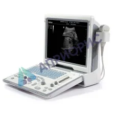 Аппарат ультразвуковой диагностики Mindray DP-50 (УЗИ-сканер)