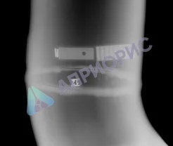 беркут 1012-120 цифровой радиографический программно-аппаратный комплекс